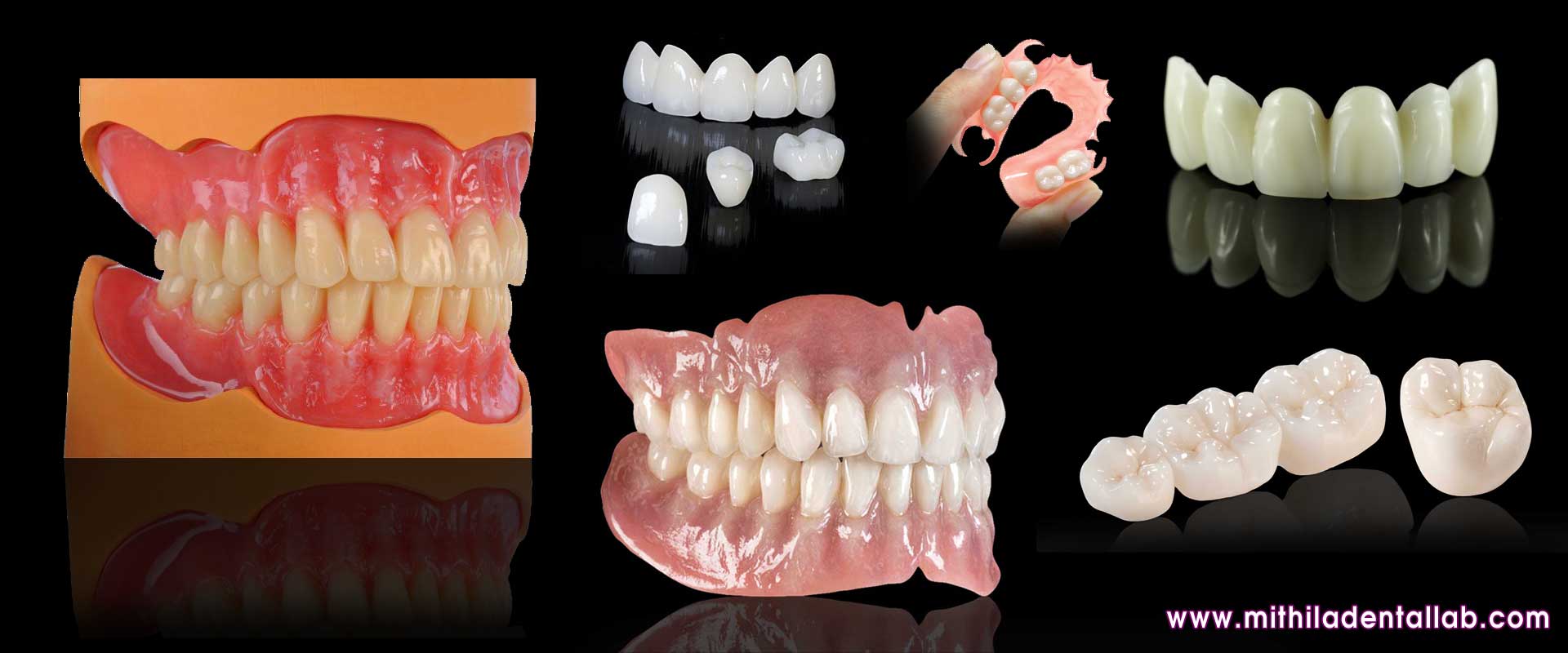 denture manufacturers exporters suppliers in india punjab ludhiana