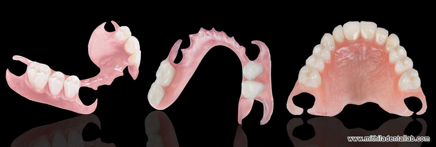 flexible denture manufacturers exporters in india punjab ludhiana