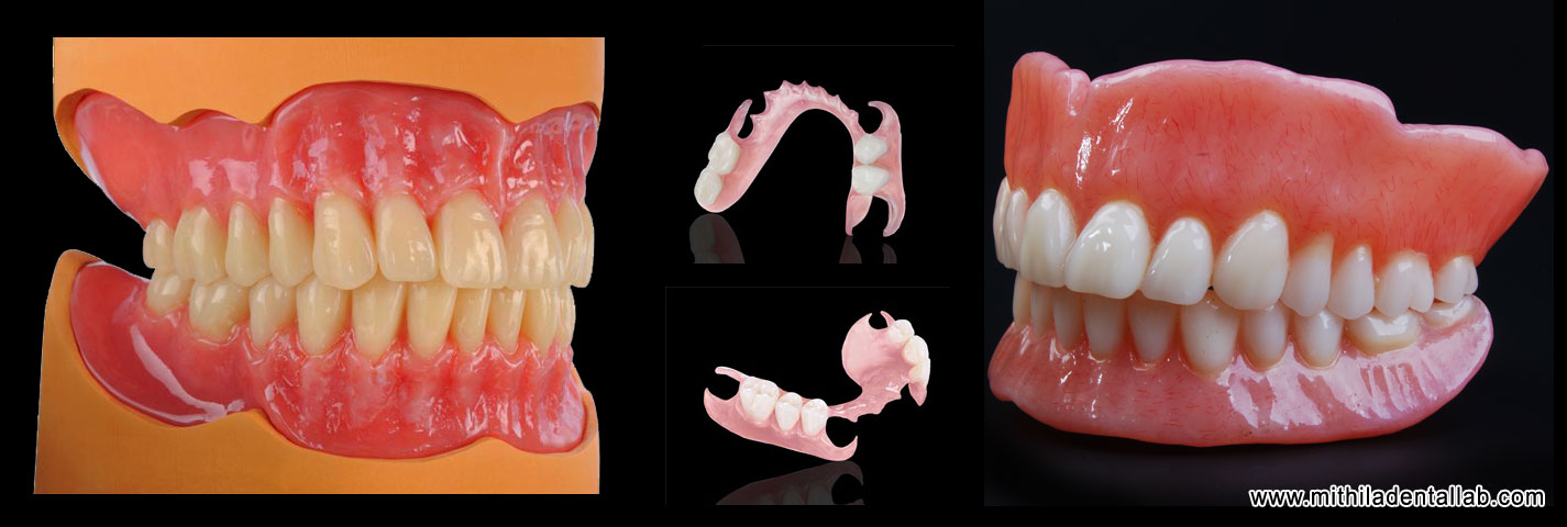 mds super unbreakable denture manufacturers exporters in india punjab ludhiana